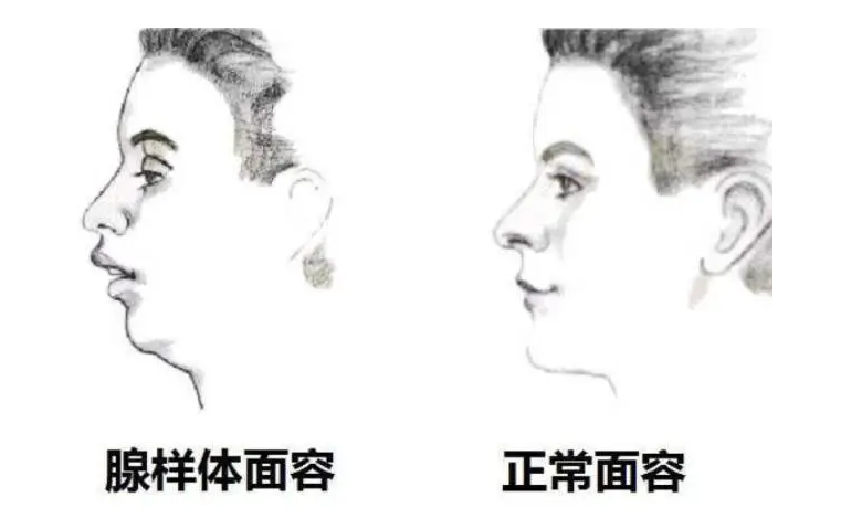 &#20048;&#40060;